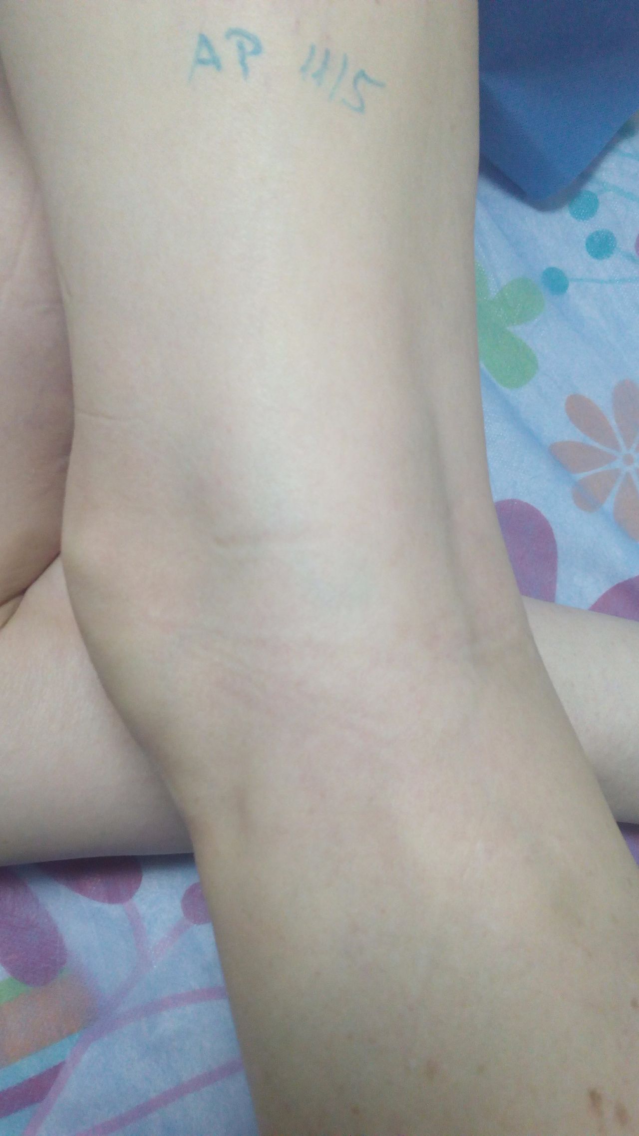 Arnaldo Strazzaboschi-5