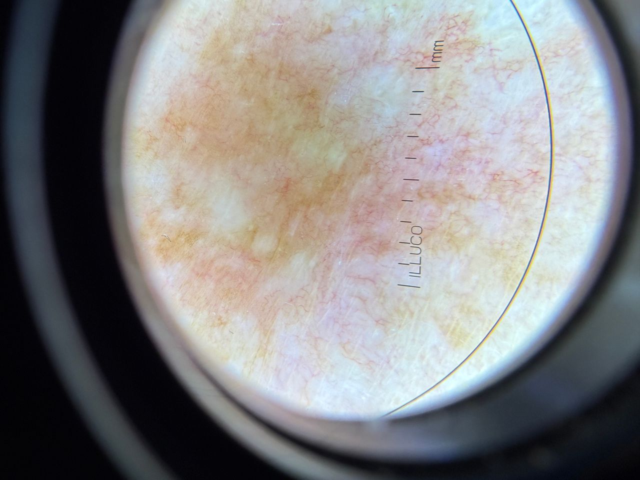 Agnieszka Snarska – Drygalska-1