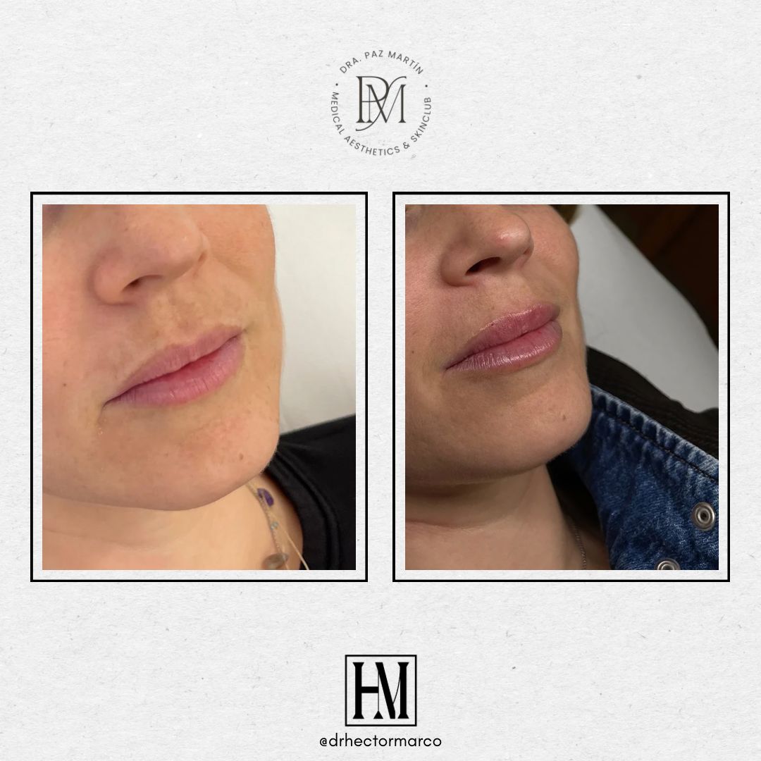 Héctor Marco Ruiz-13