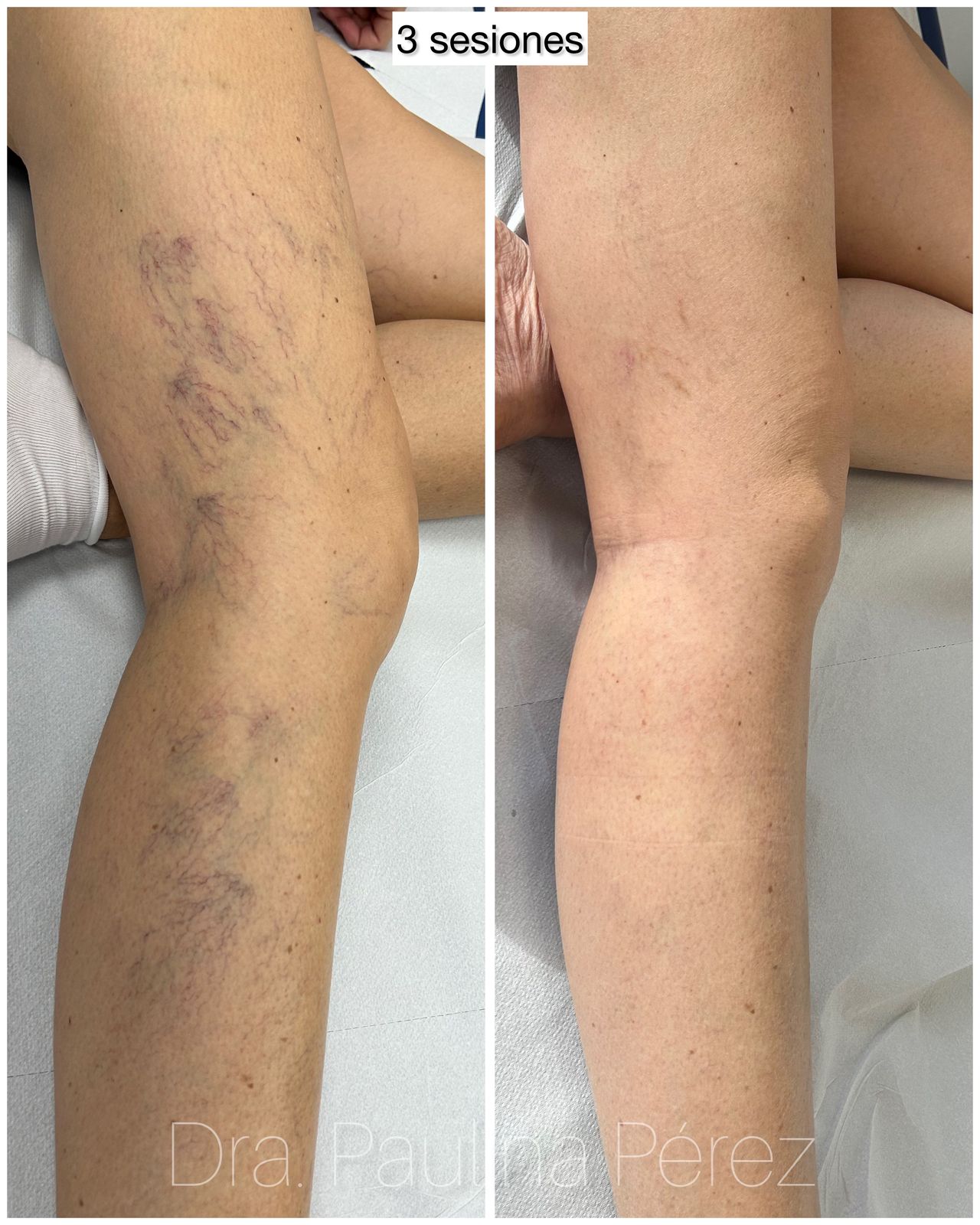 Paulina Pérez Ramírez-14