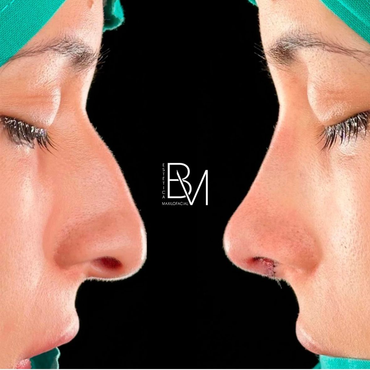 Beatriz Moralejo-30