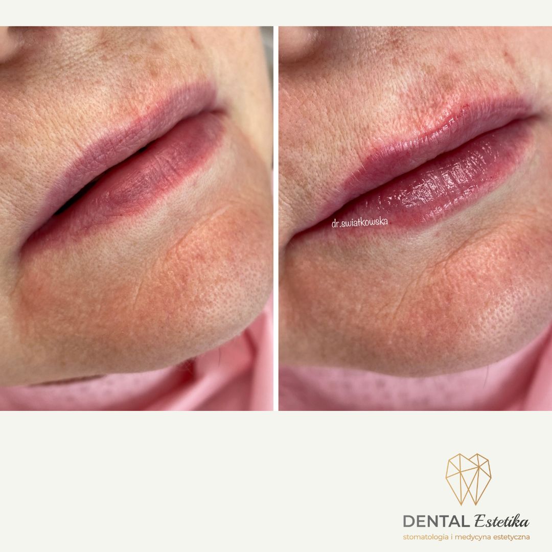 Angelika Świątkowska-46