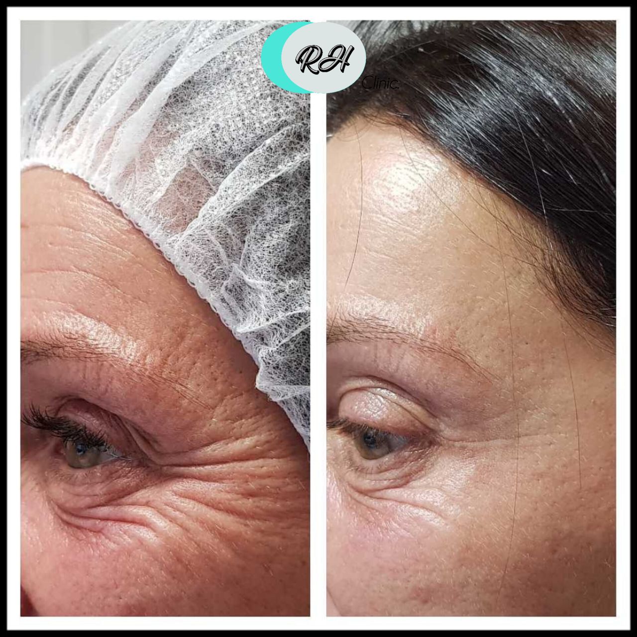 Rosalba Herrero Zerpa-112