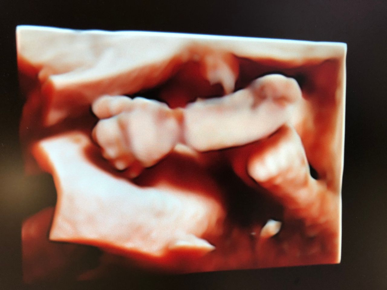 Katarzyna Leszczyńska-13