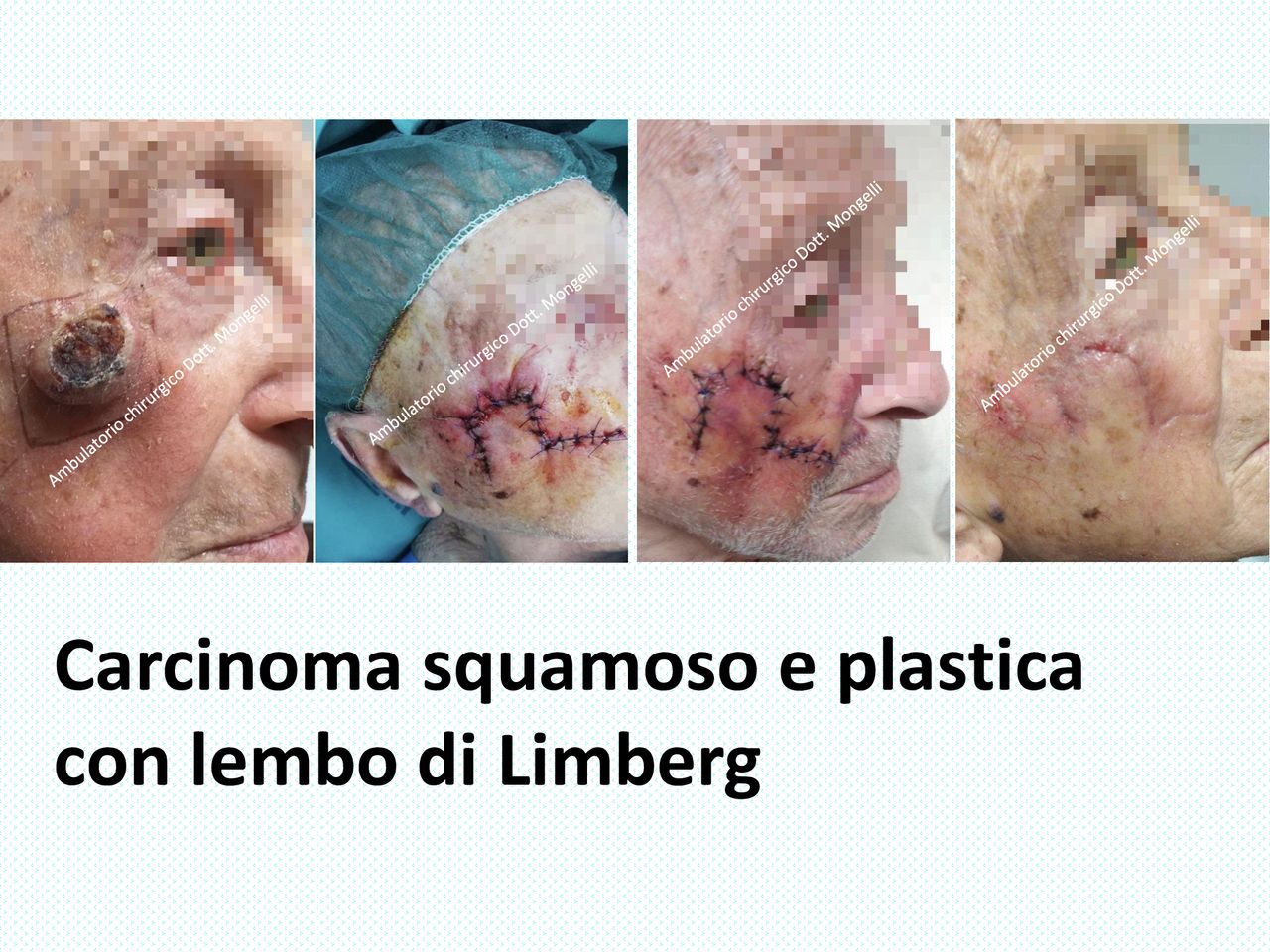 Matteo Antonio Mongelli-0