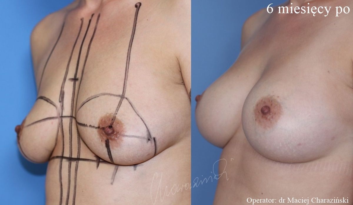 Maciej Charaziński-115