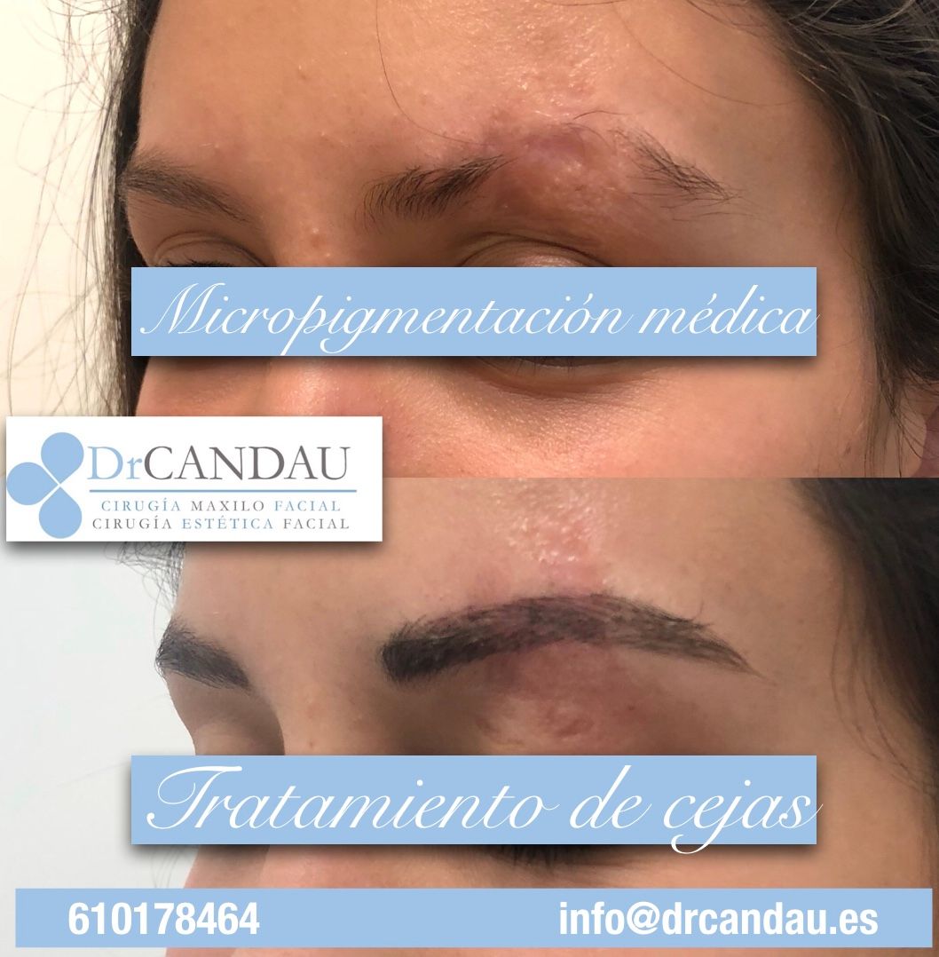 Alberto Candau Álvarez-32