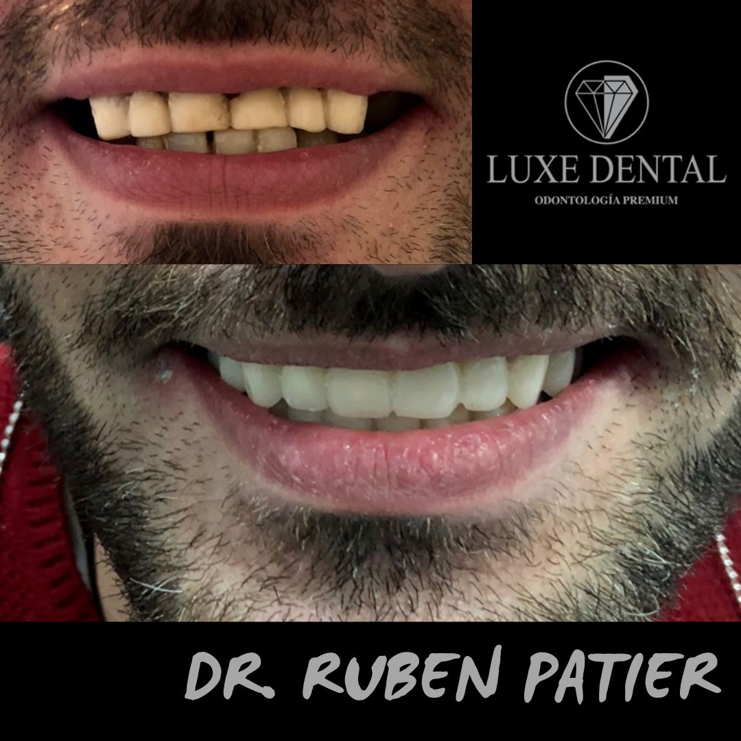 Ruben Patier Martin-28