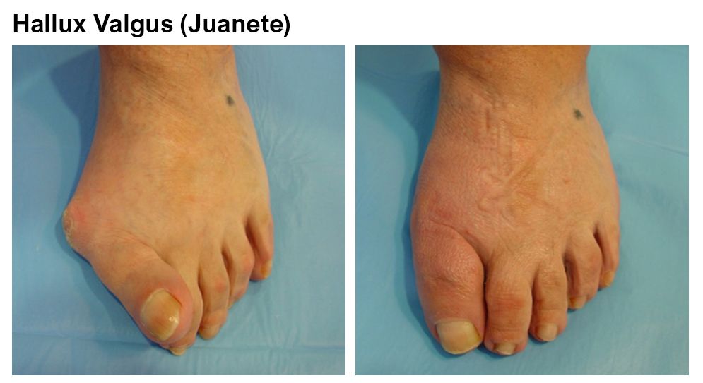 Luis Castillo Sanchez-7