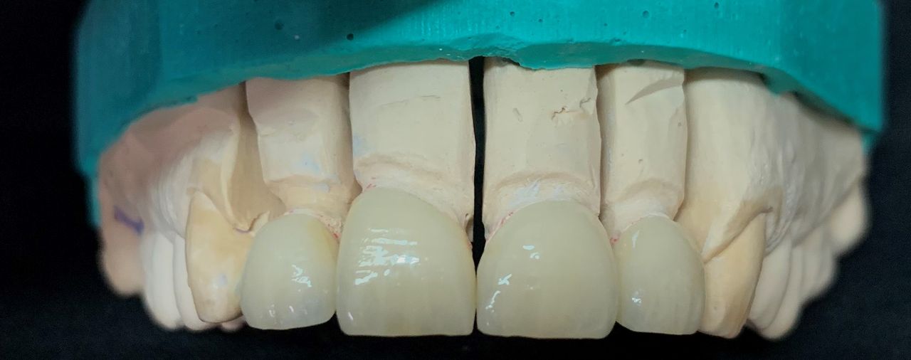 Marco Della Rovere-4