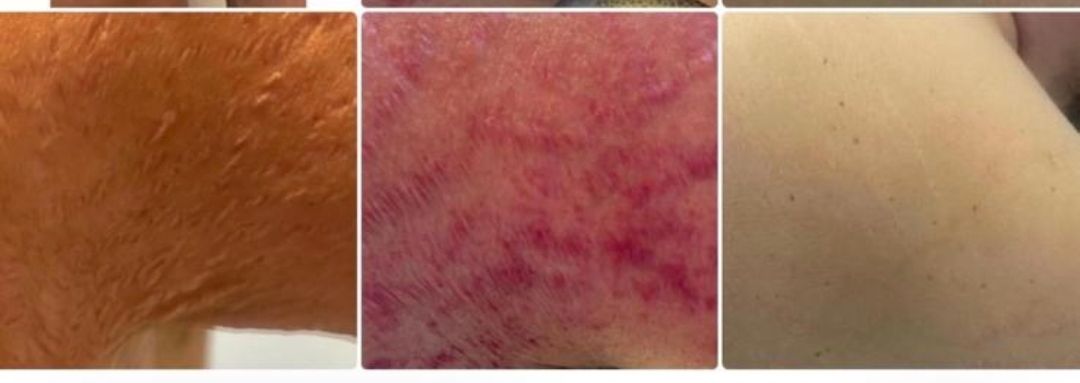 Guglielmina Chinaglia-9