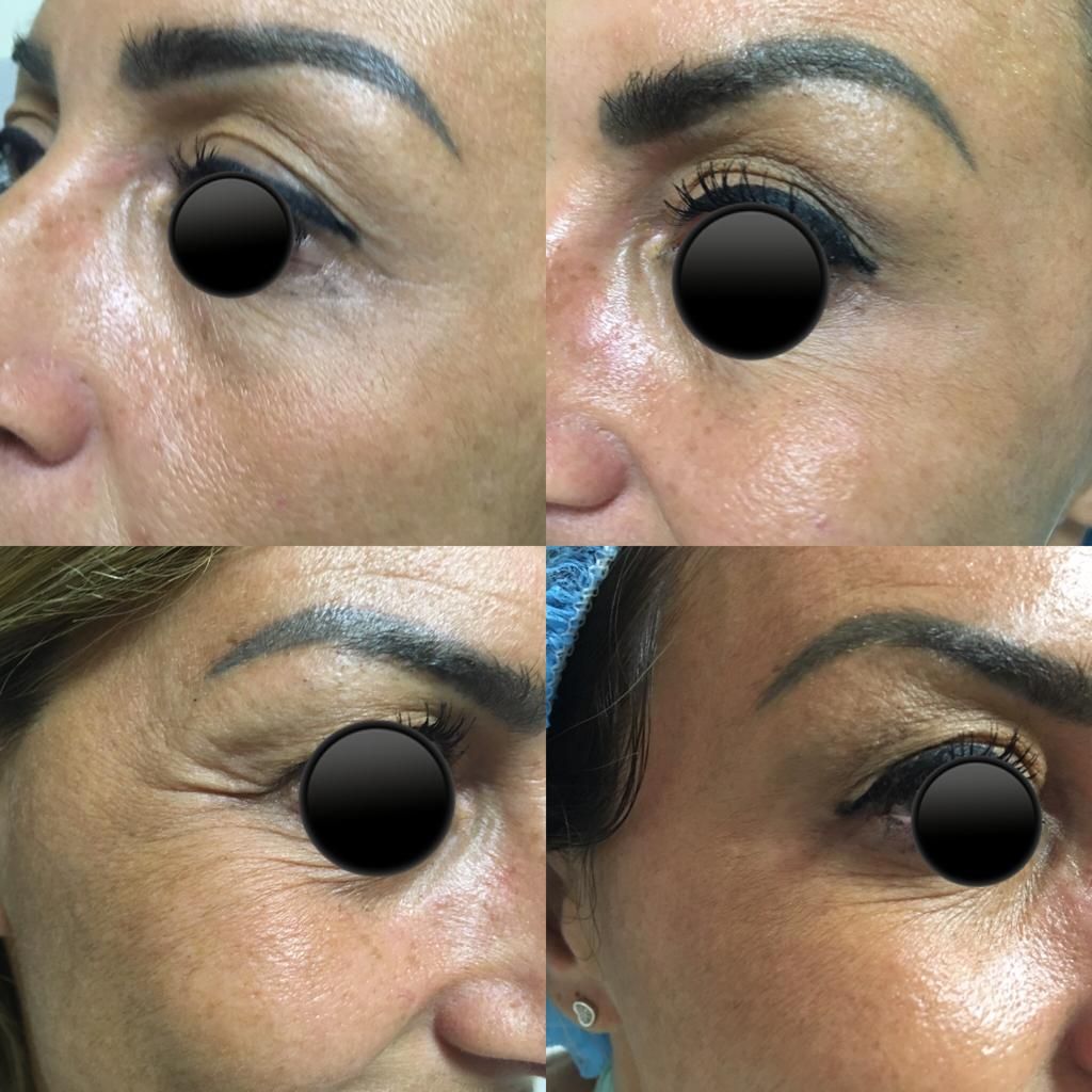 Virginia Cristina Rapisarda-81