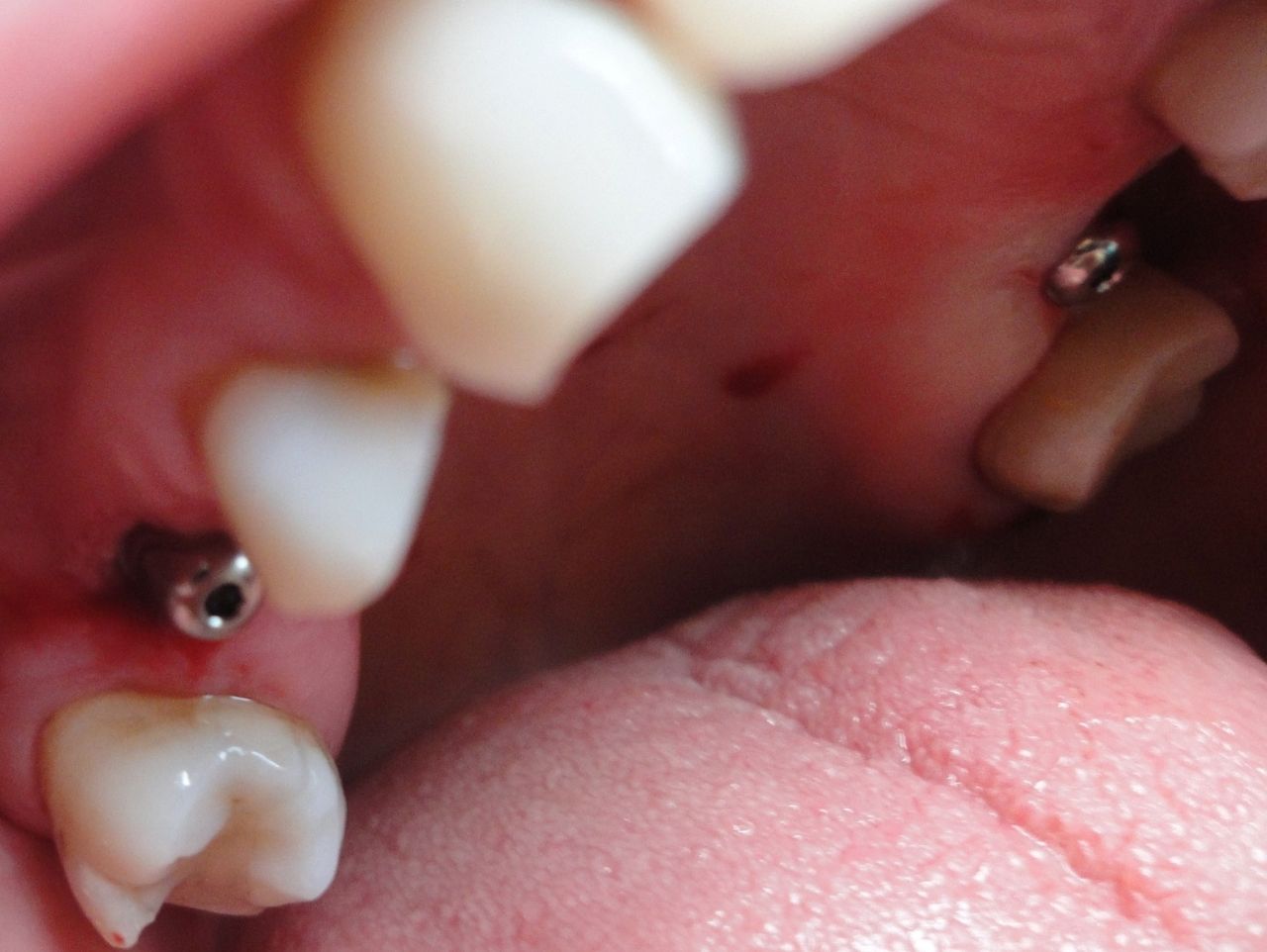 Krzysztof Zieliński-20