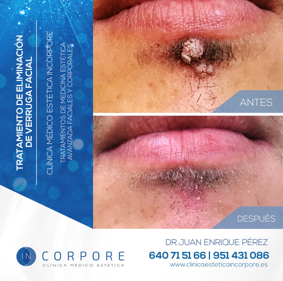 Juan Enrique Pérez Enríquez-128