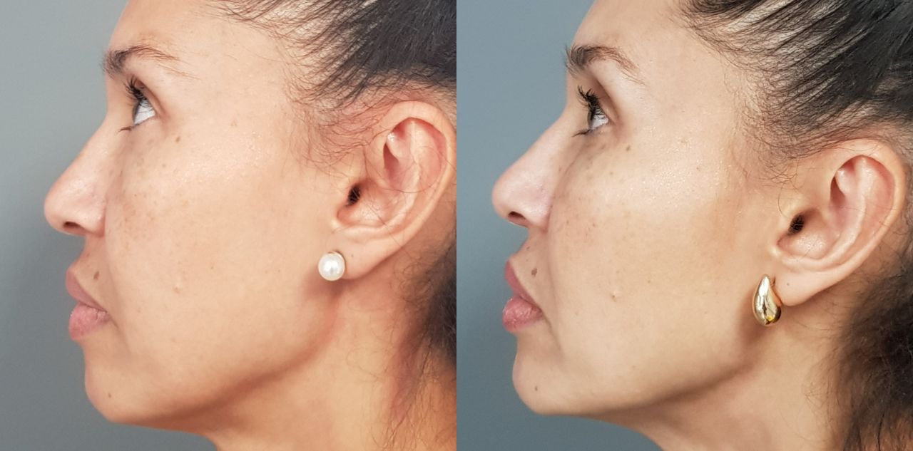 Rosalba Herrero Zerpa-481