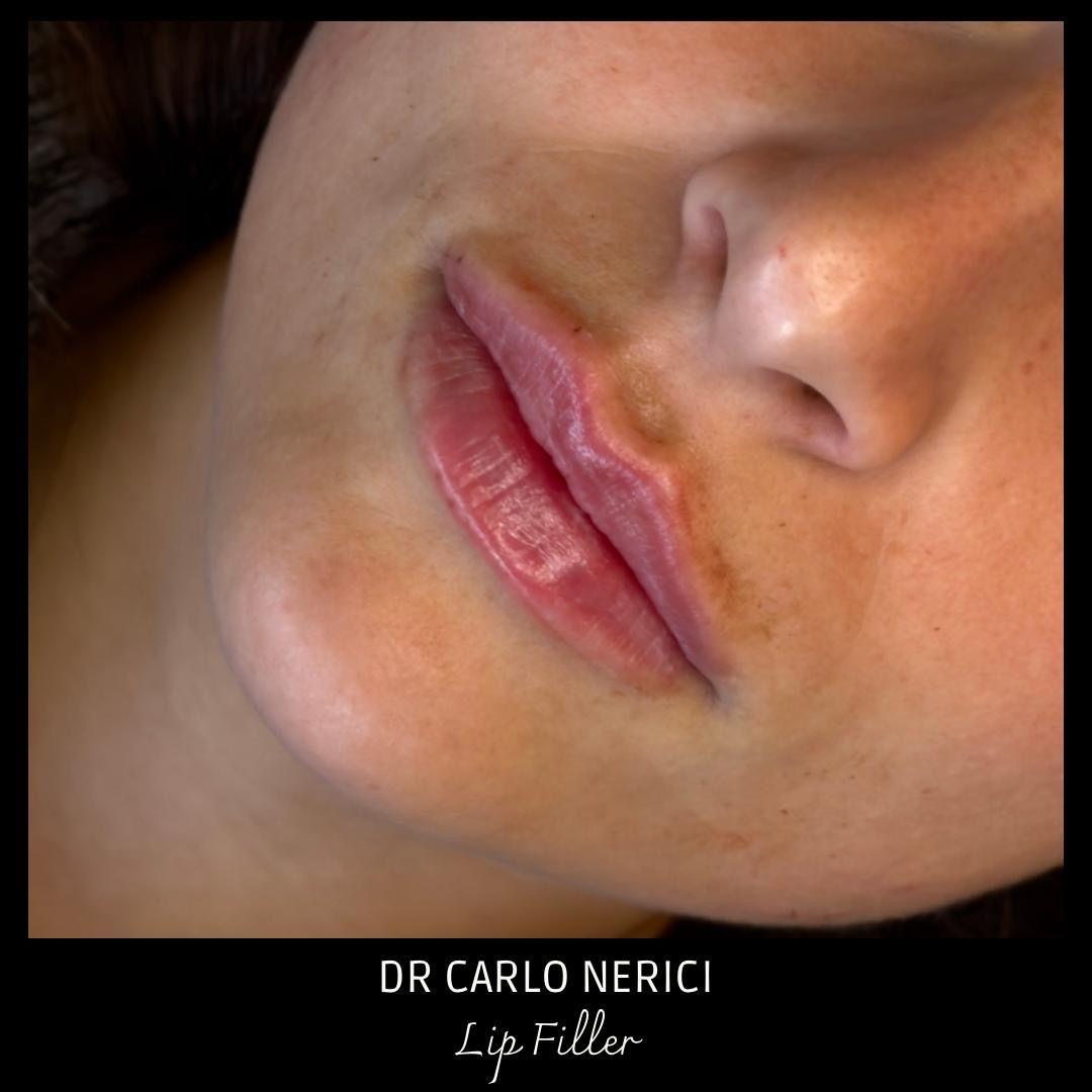 Carlo Nerici-14