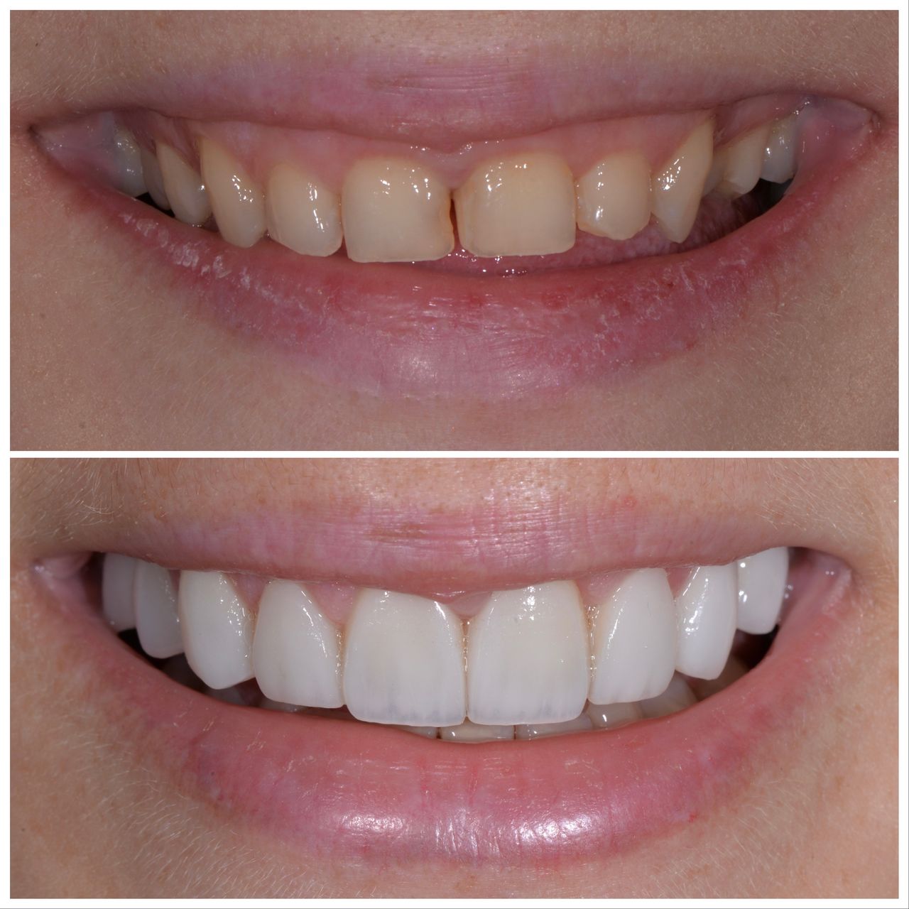 Martin Bartoszcze-45