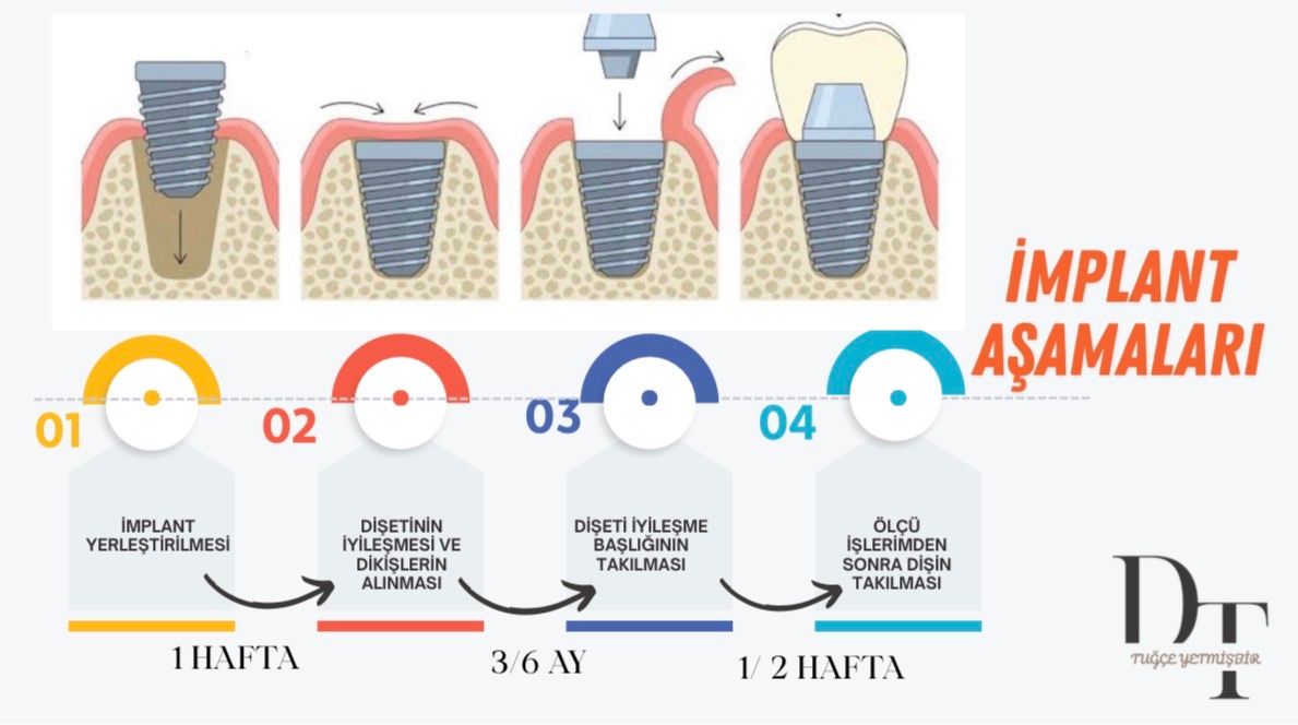 Tuğçe Yetmişbir-16