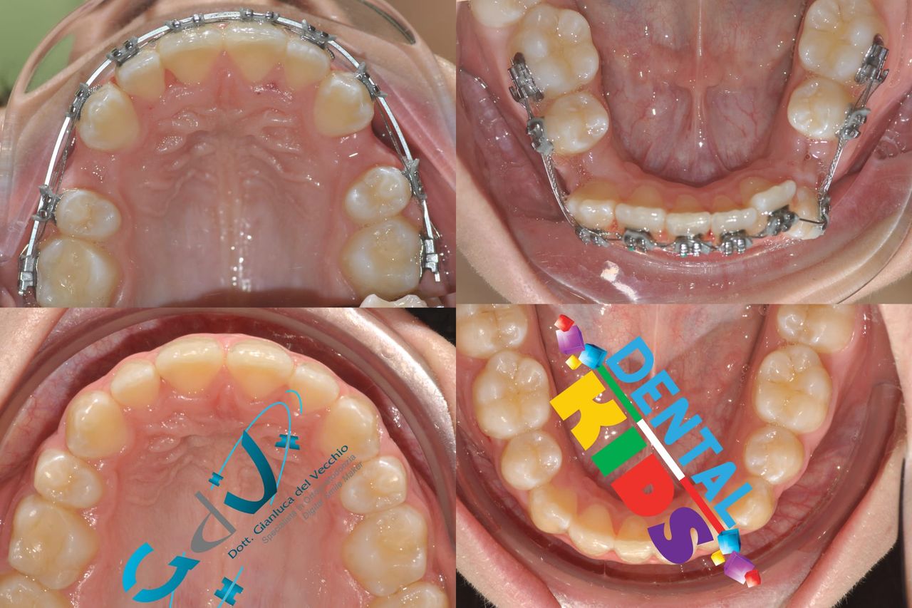 Gianluca Del Vecchio-171