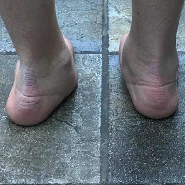 Massimo Brandolin-23