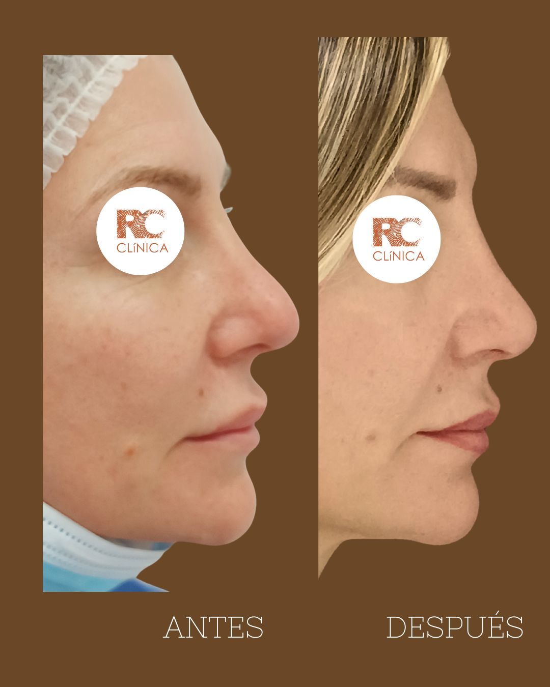 Roy Camacho Leone-10