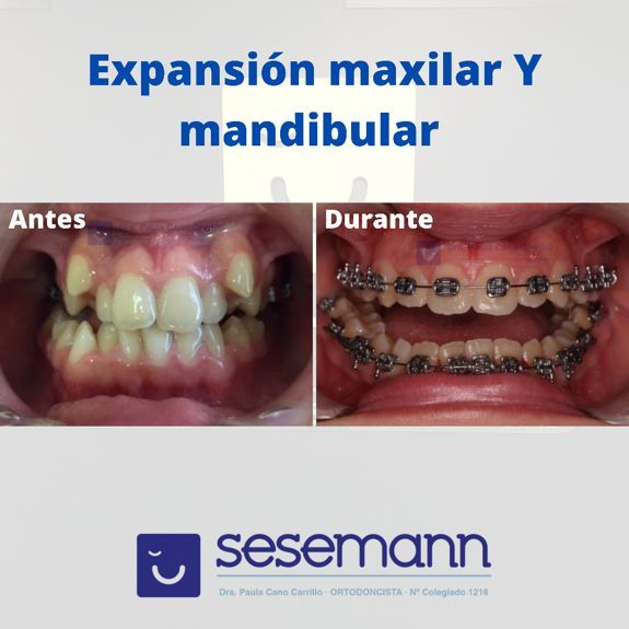 Paula Cano Carrillo-80