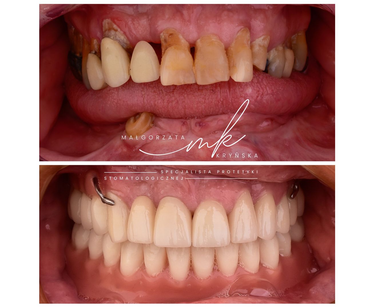 Małgorzata Kryńska-0