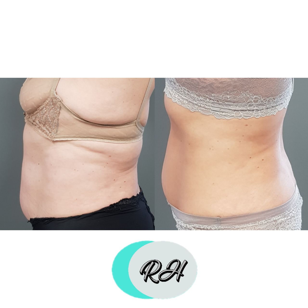 Rosalba Herrero Zerpa-190