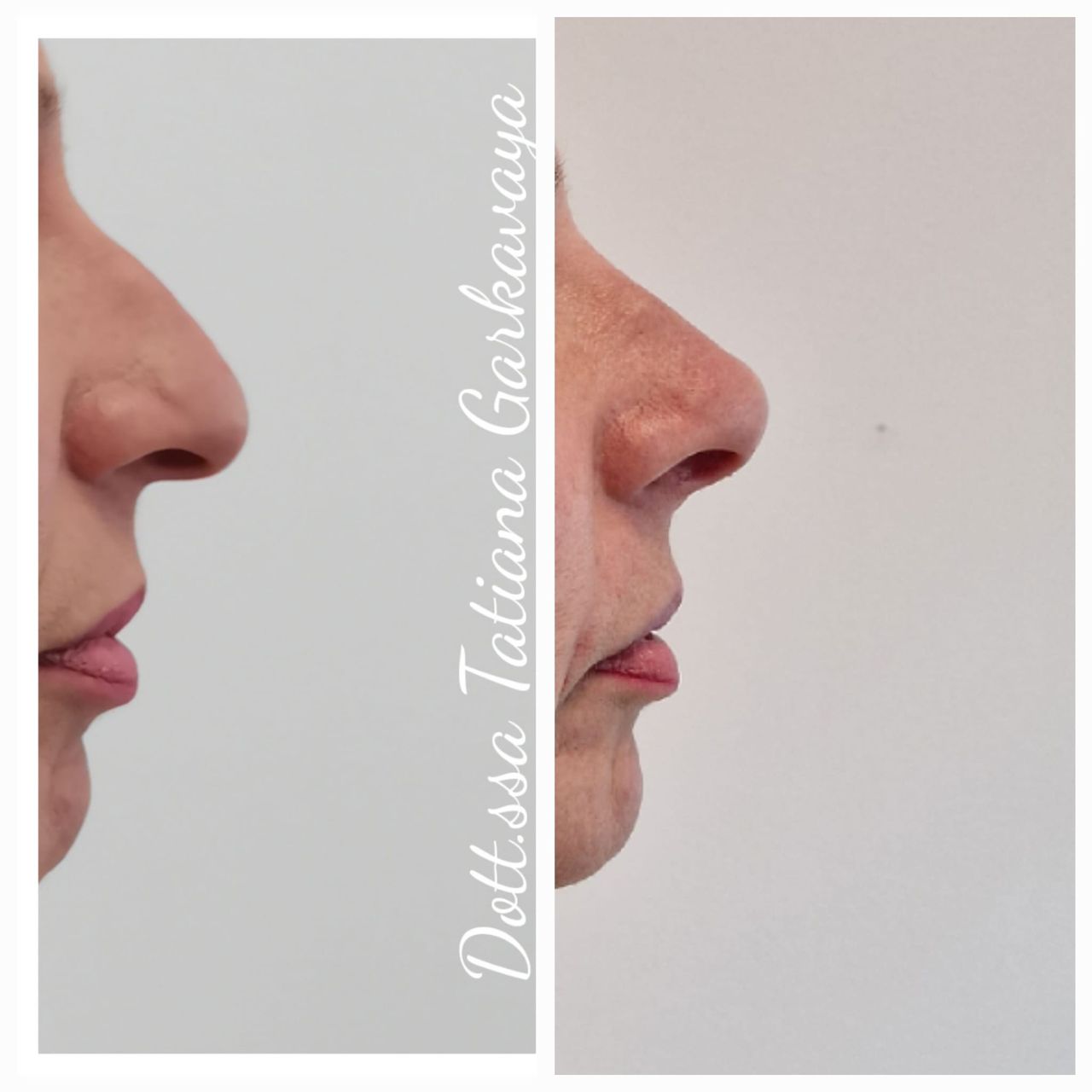 Tatiana Garkavaya-20