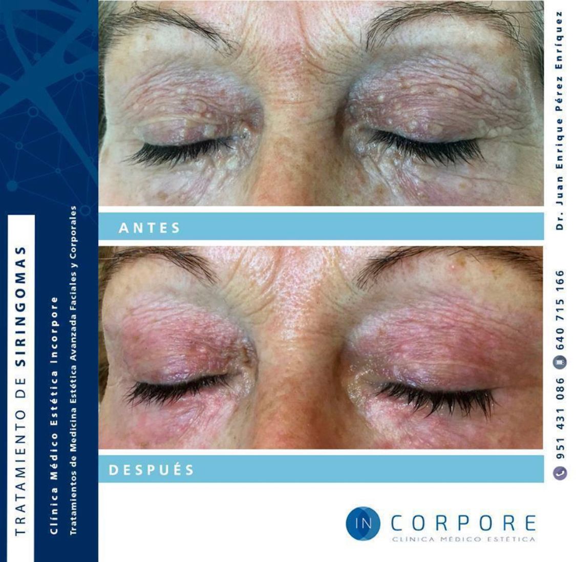 Juan Enrique Pérez Enríquez-72