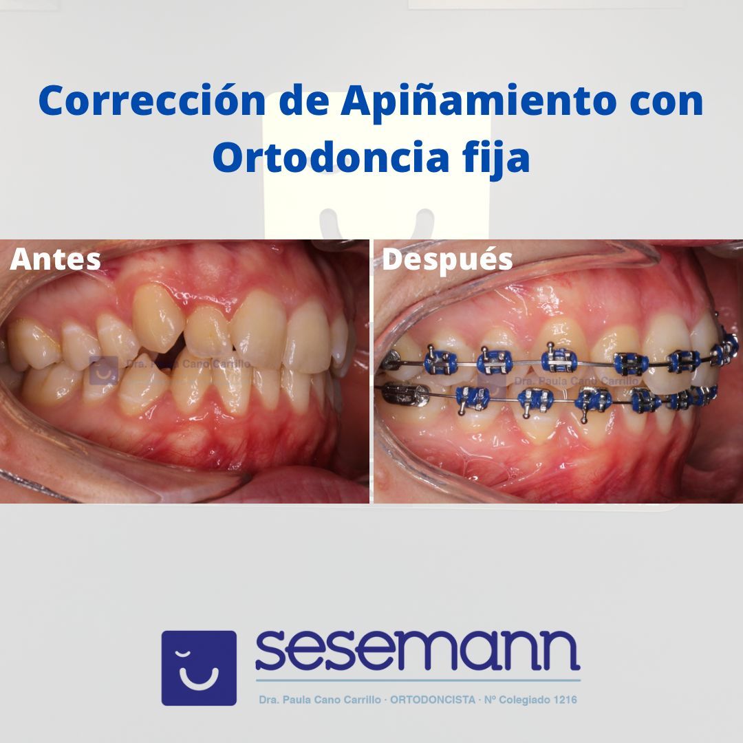 Paula Cano Carrillo-31