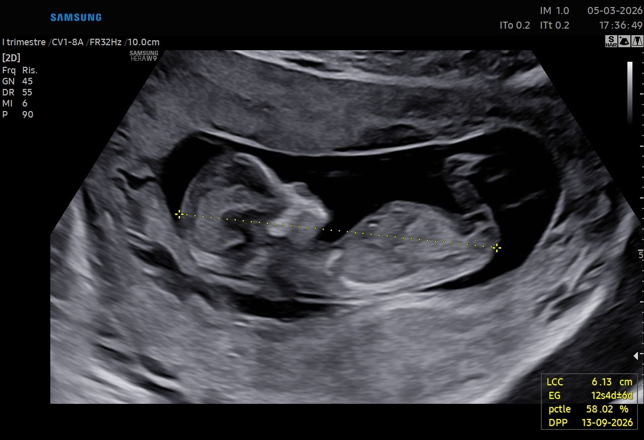 Valentina Del Negro-13