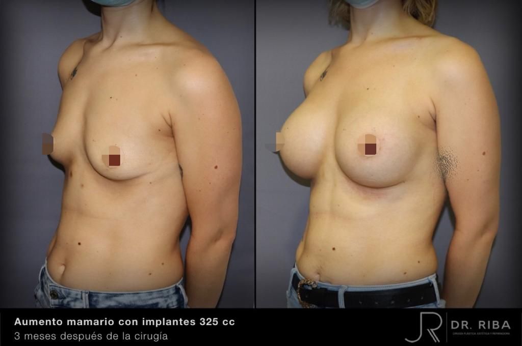 Jordi Riba Vilchez-39