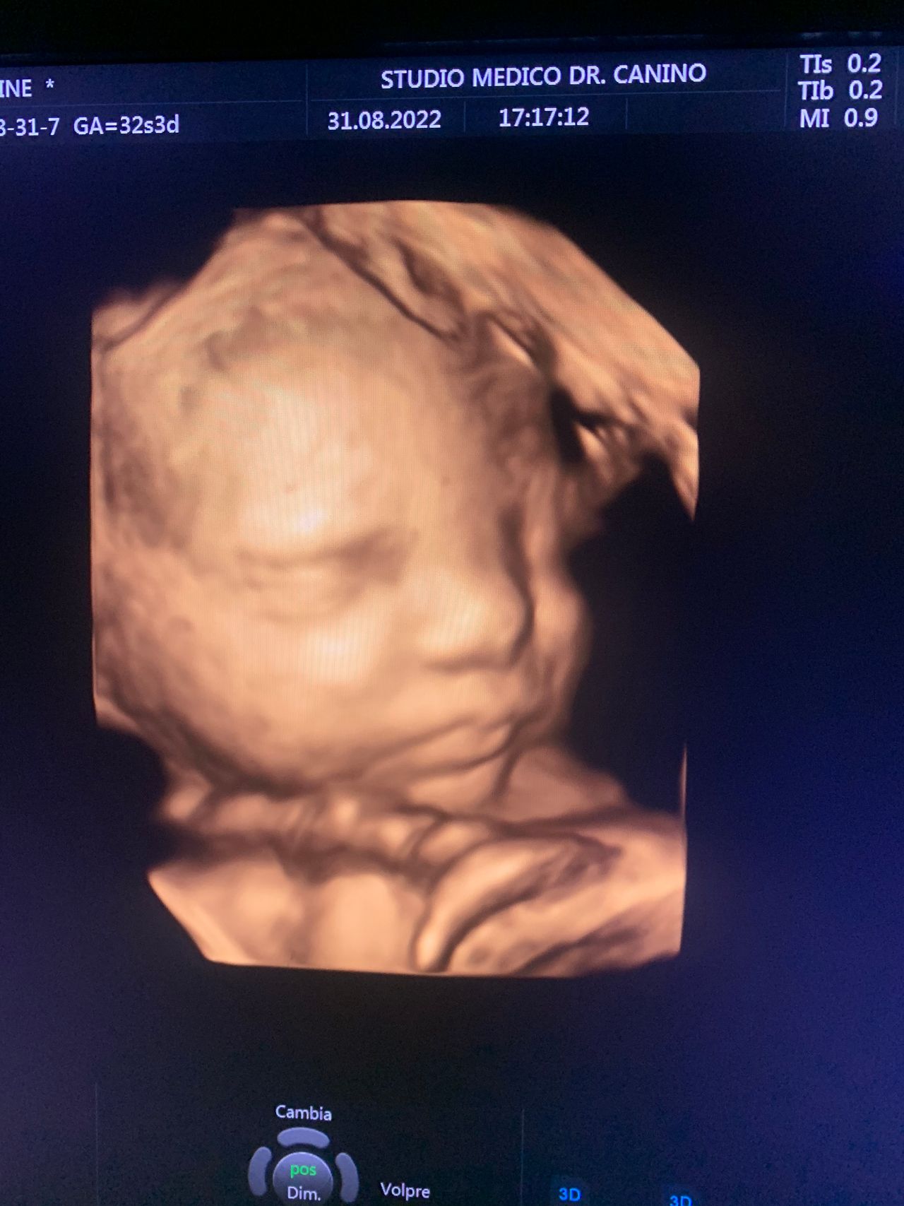 Francesco Antonio Bisogni-1