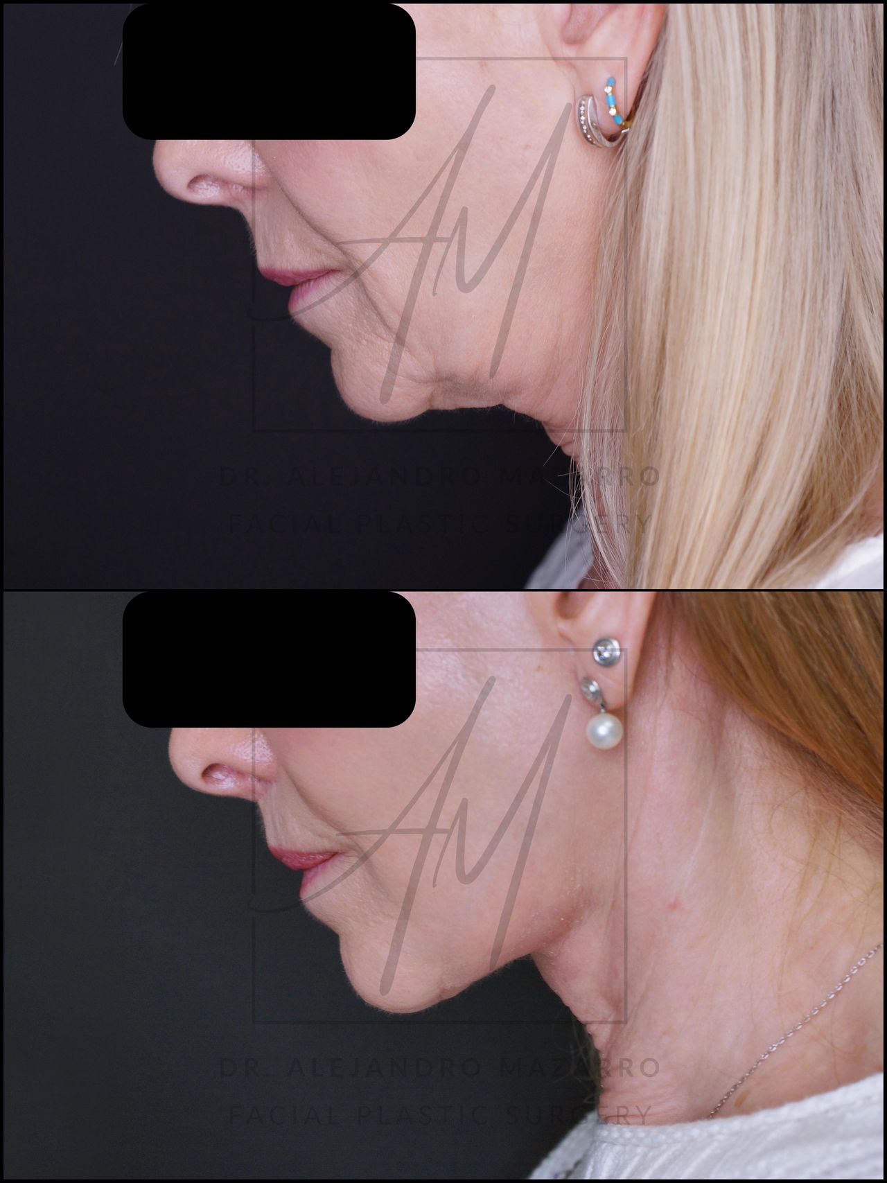 Alejandro Mazarro Campos-4