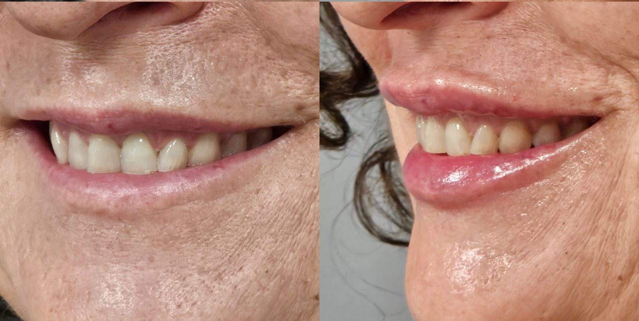 Rosalba Herrero Zerpa-540