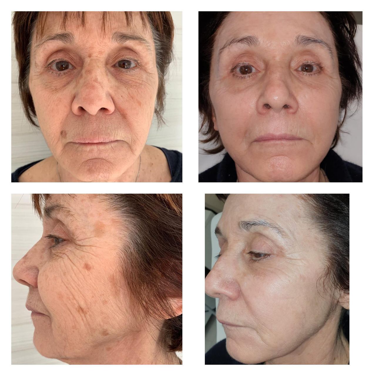 Fabio Antonio Caprara-2