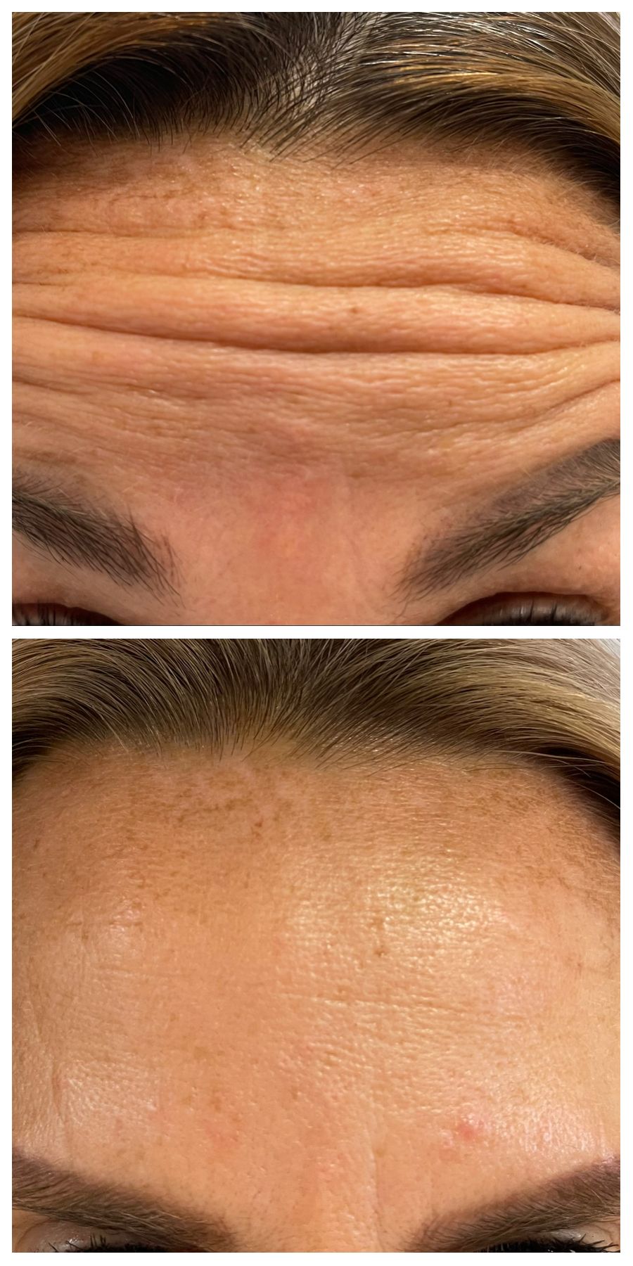 Agnieszka Bacińska-4