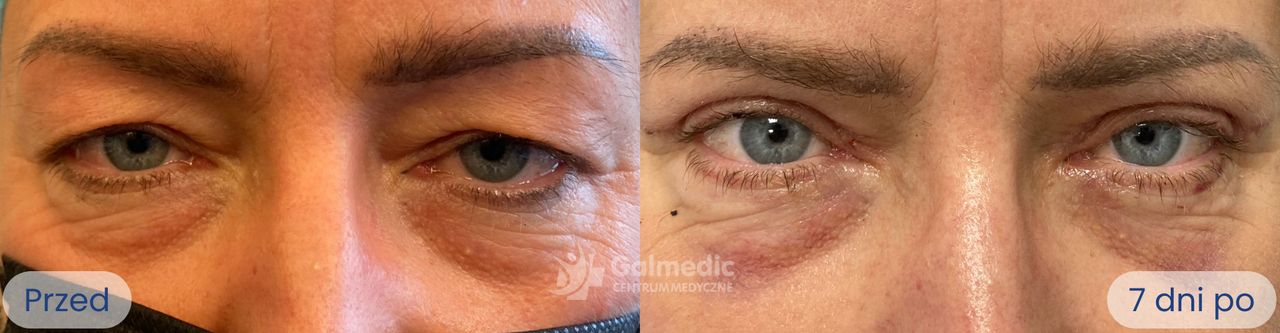 Jakub Staniszewski-4