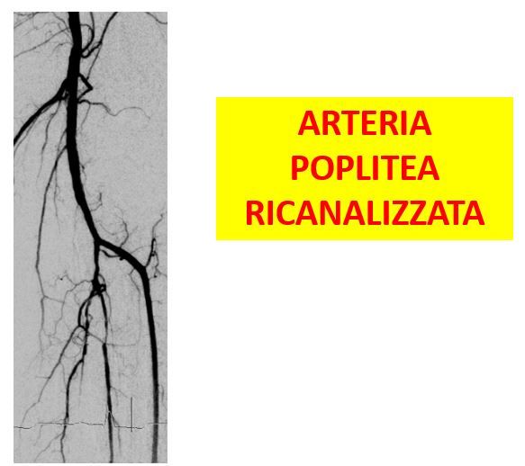 Gianni De Angelis-14