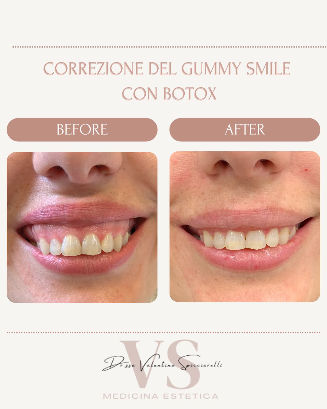 Valentina Spicciarelli-9