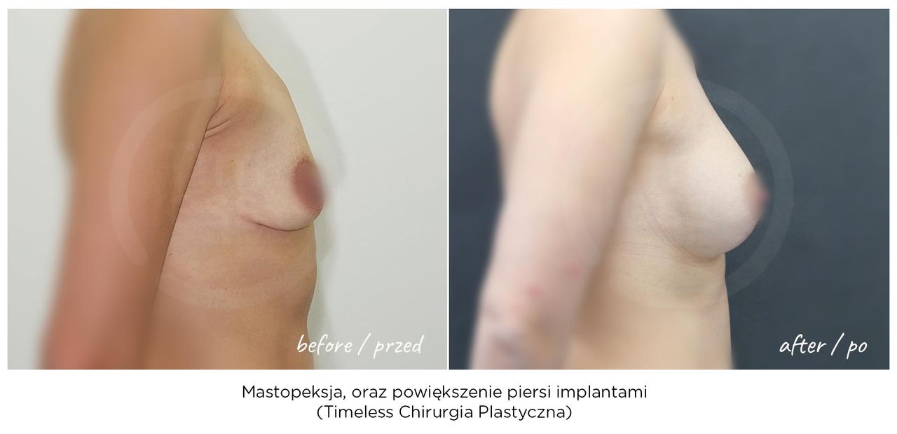 Janusz Jaworowski-44