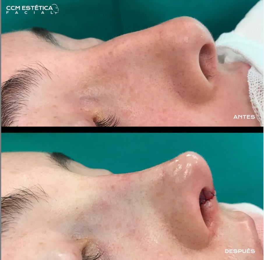 Alvaro Perez Villar-10