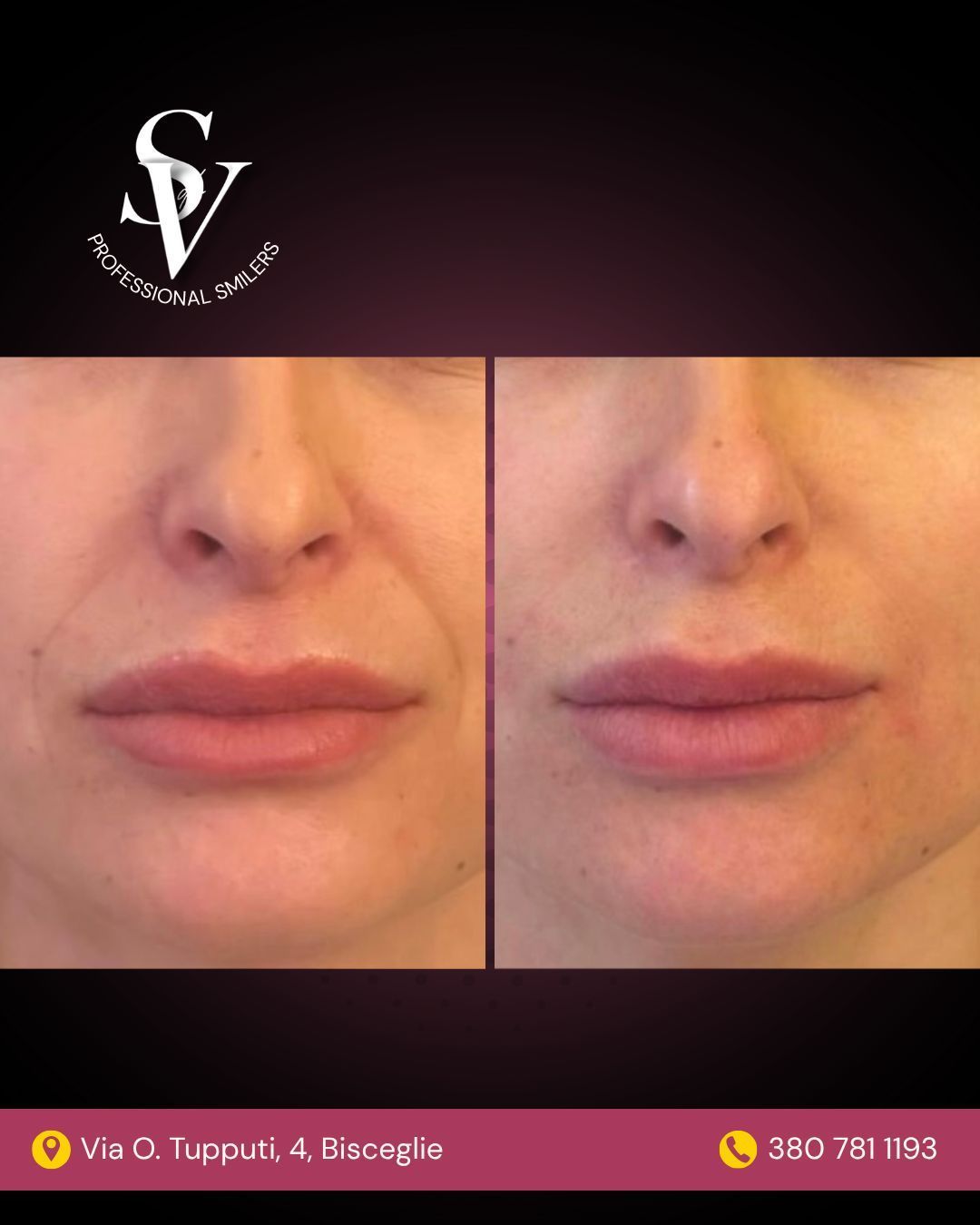 Silvia Squeo De Villagomez-24