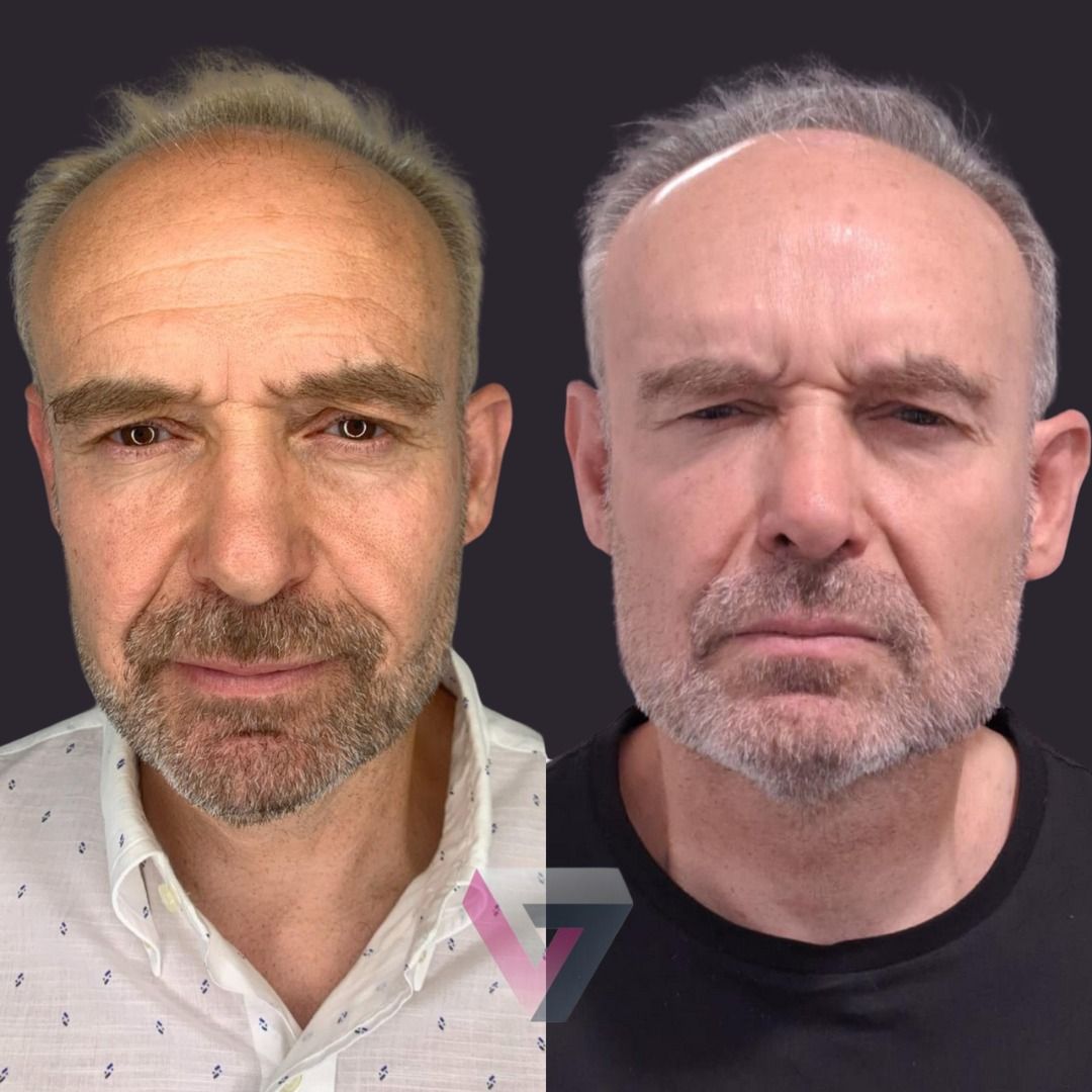 Victoria Trasmonte-120