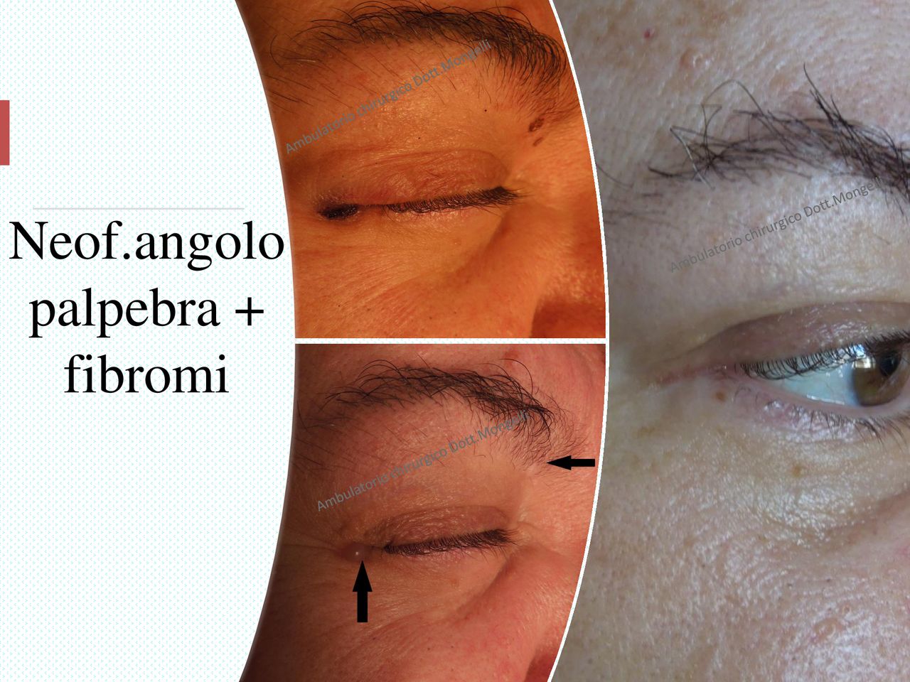 Matteo Antonio Mongelli-17