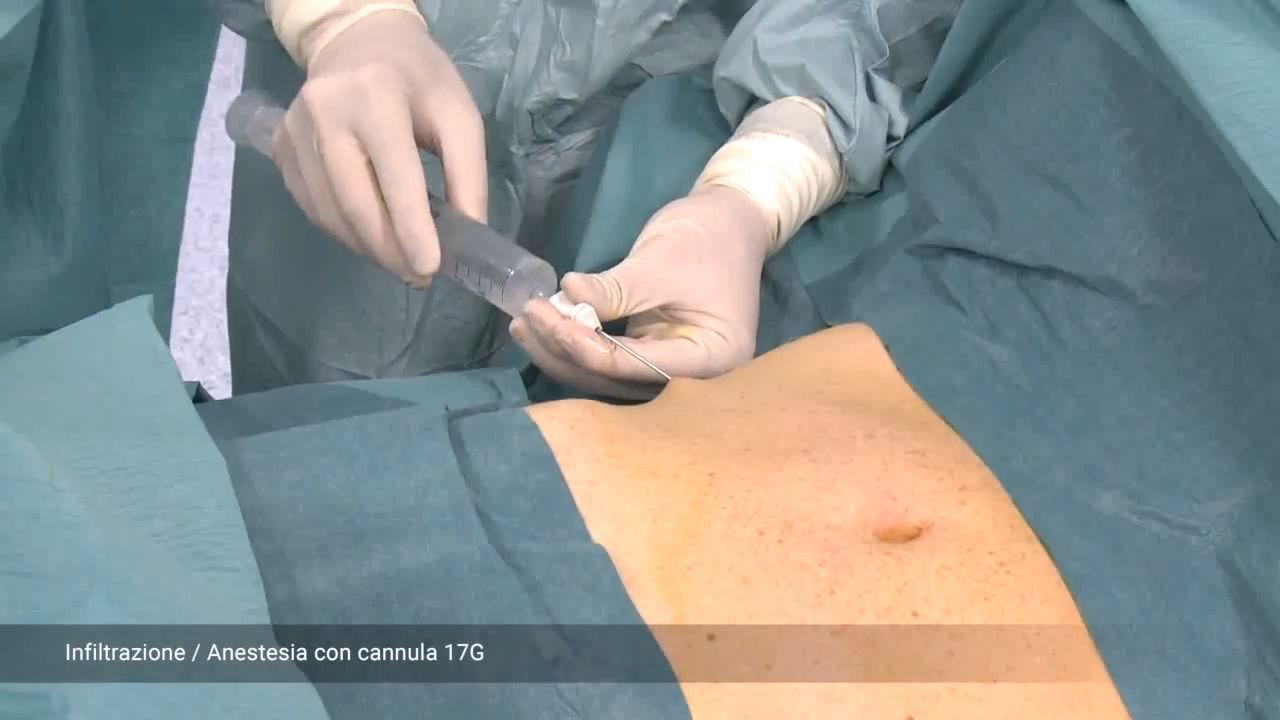 Giuseppe Ambrosino-3