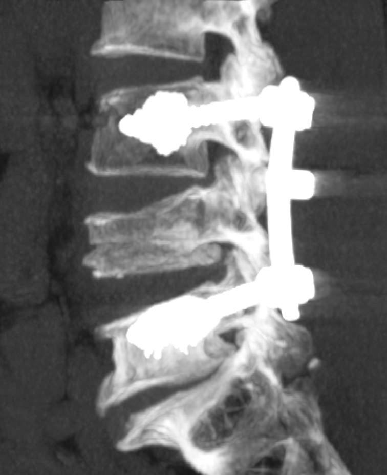 Alessandro Borderi-17