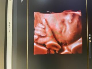 Domenico D'assisi-20