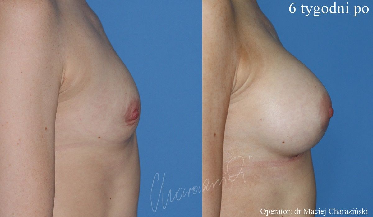 Maciej Charaziński-121